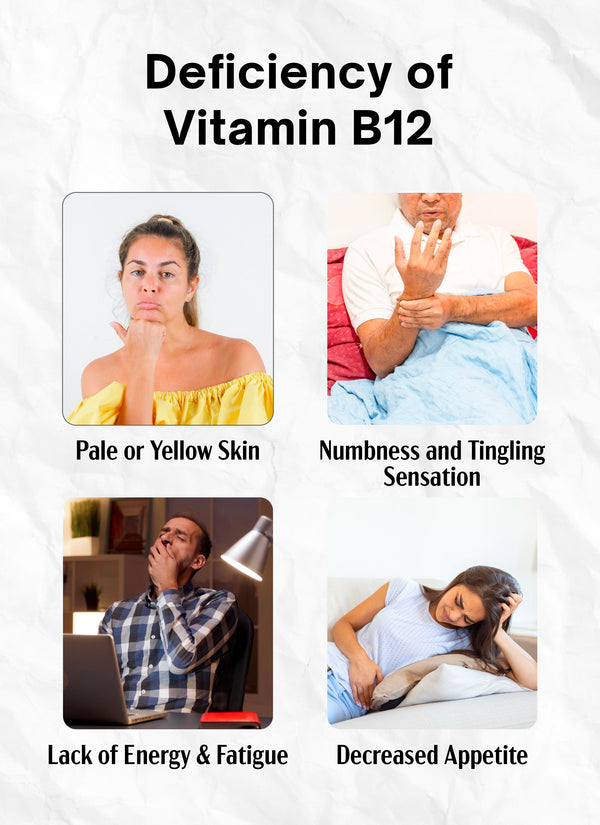 Vitamin B12 1000 mcg