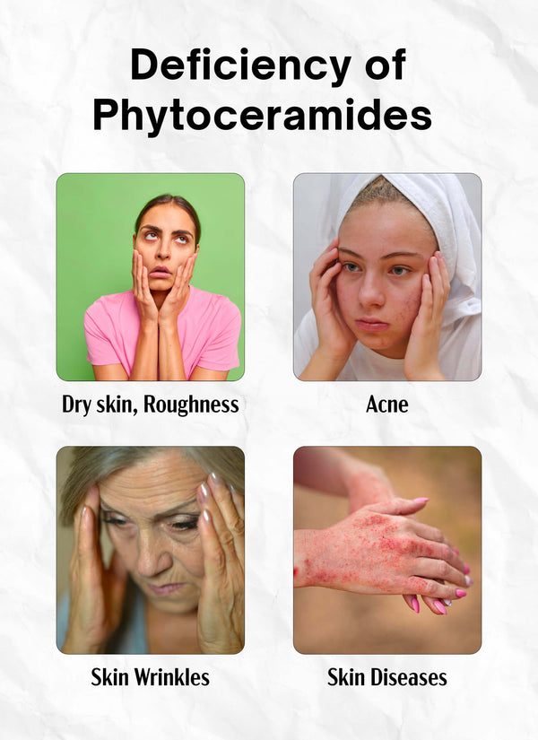 Phytoceramides