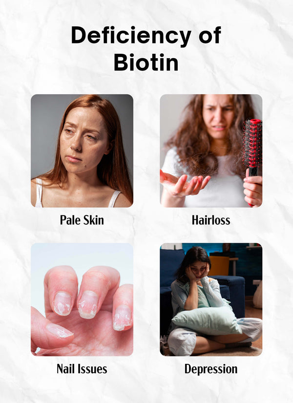 Biotin Max 5000 mcg